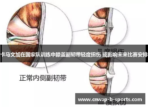 卡马文加在国家队训练中膝盖副韧带轻度扭伤 或影响未来比赛安排